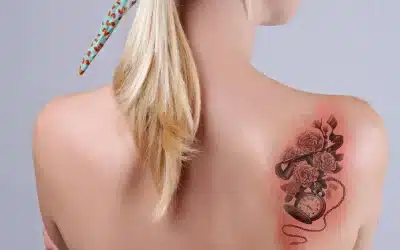 ¿Cómo curar un tatuaje infectado?